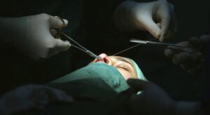 Merdiven altı estetik ve dövme İşlemlerine karşı uzman uyarısı