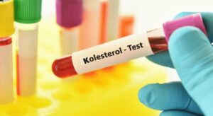 Kolesterolünüzü düşürüyor! Bu besinler imdadınıza hızır gibi yetişiyor